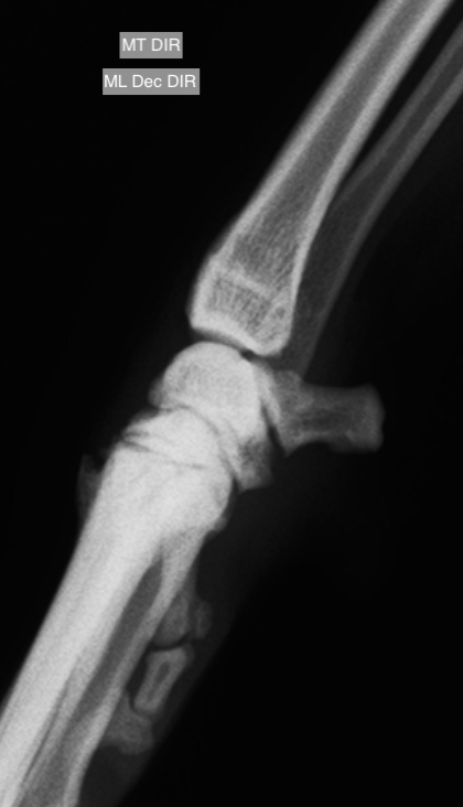 Carpo e dígitos mediolateral