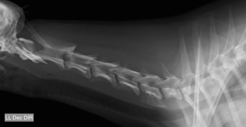 Segmento cervical laterolateral